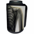 3dRose Scenes from the Past Magic Lantern - Vintage Xray of a Human Shoulder Magic Lantern Slide Medical 1890 - Can Cooler Bottle Wrap (cc_246409)