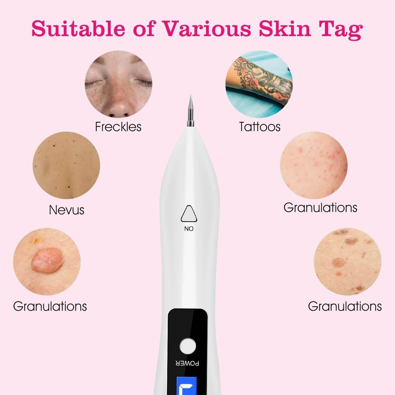 Portable Skin Tag Repair Kit with 6 Replaceable Needles
